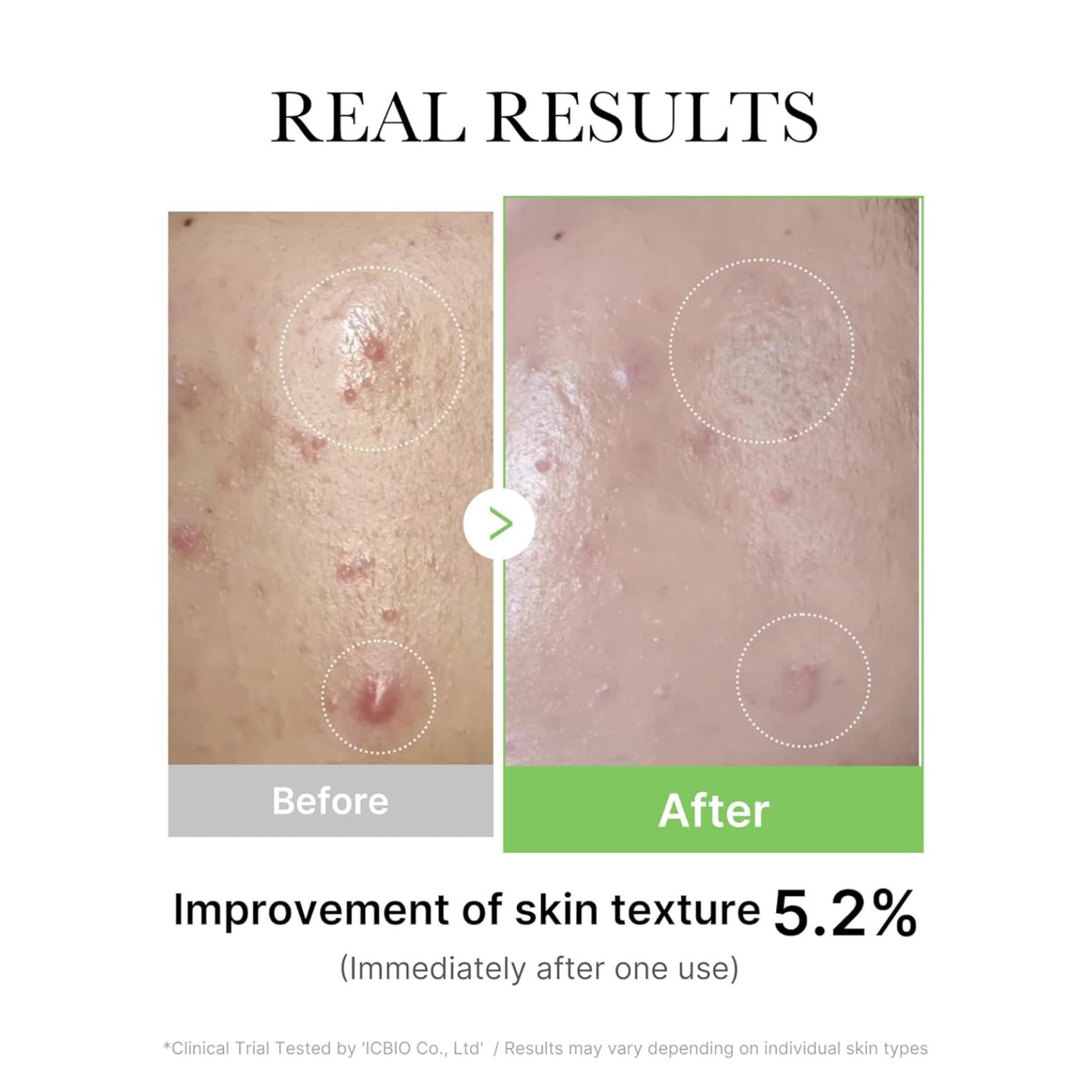 MEDICUBE Exosome Cica Serum 30ml