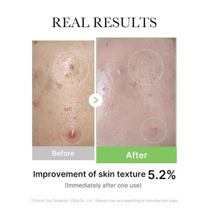 MEDICUBE Exosome Cica Serum 30ml